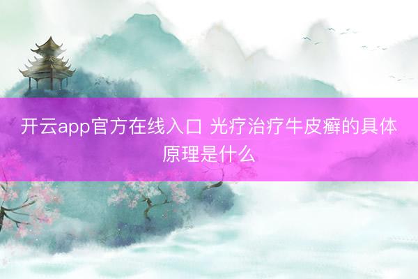 开云app官方在线入口 光疗治疗牛皮癣的具体原理是什么